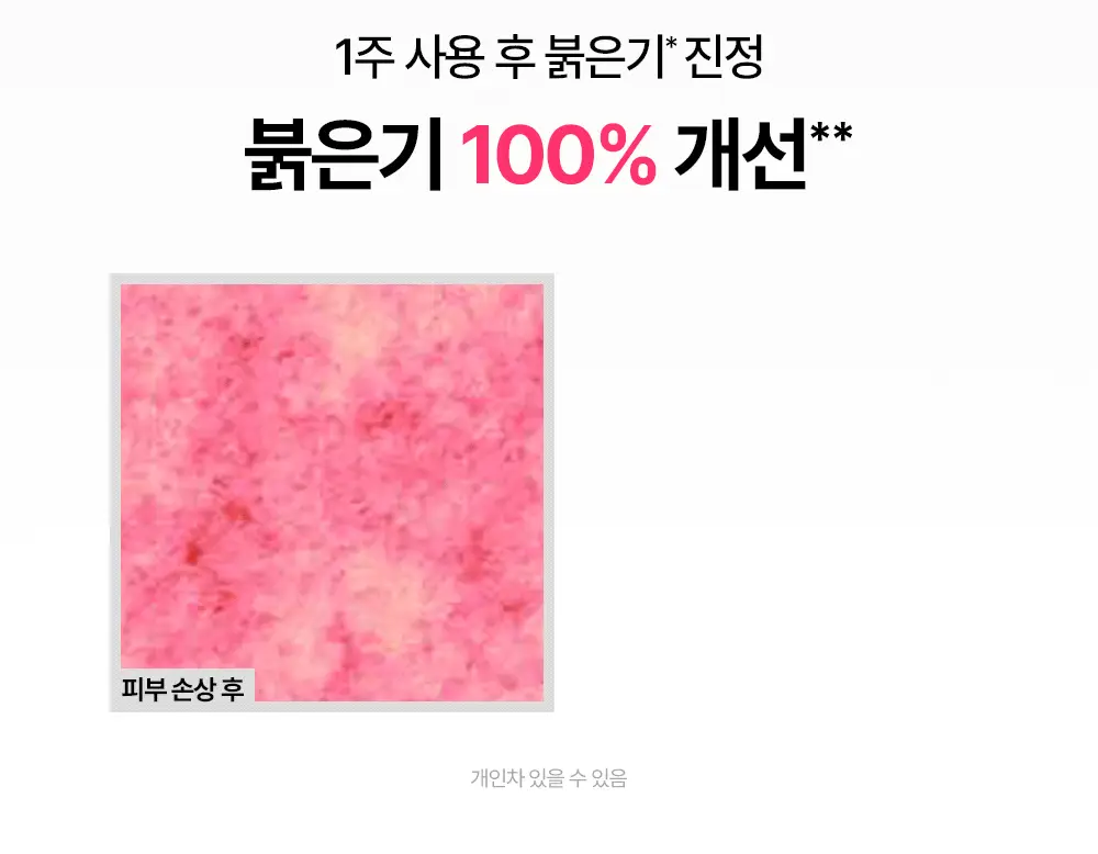 [트러블 피부 추천/붉은기 진정 앰플] 제로이드 핌프로브 카밍 앰플 30ml 상세페이지 15